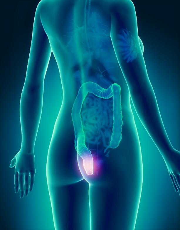 Enddarm-Erkrankungen Enddarm-Erkrankungen